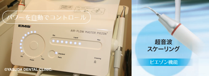 超音波スケーラー