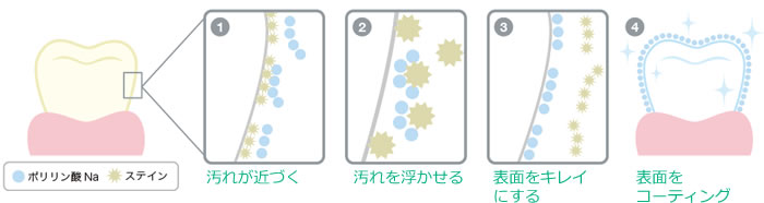 ポリリン酸ホワイトニングの仕組み